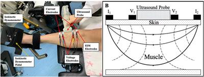 Correlation Between Muscle Structures and Electrical Properties of the Tibialis Anterior in Subacute Stroke Survivors: A Pilot Study
